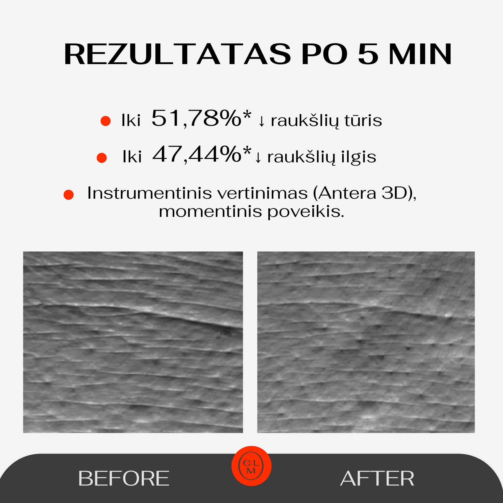 5 Minute Revolution paakių padeliai