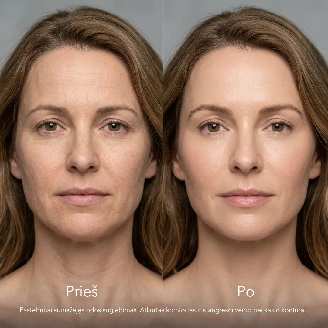 IŠANKSTINIS UŽSAKYMAS: Skin Boost Technique R-PDRN veido ir kaklo odos eliksyras 30ml