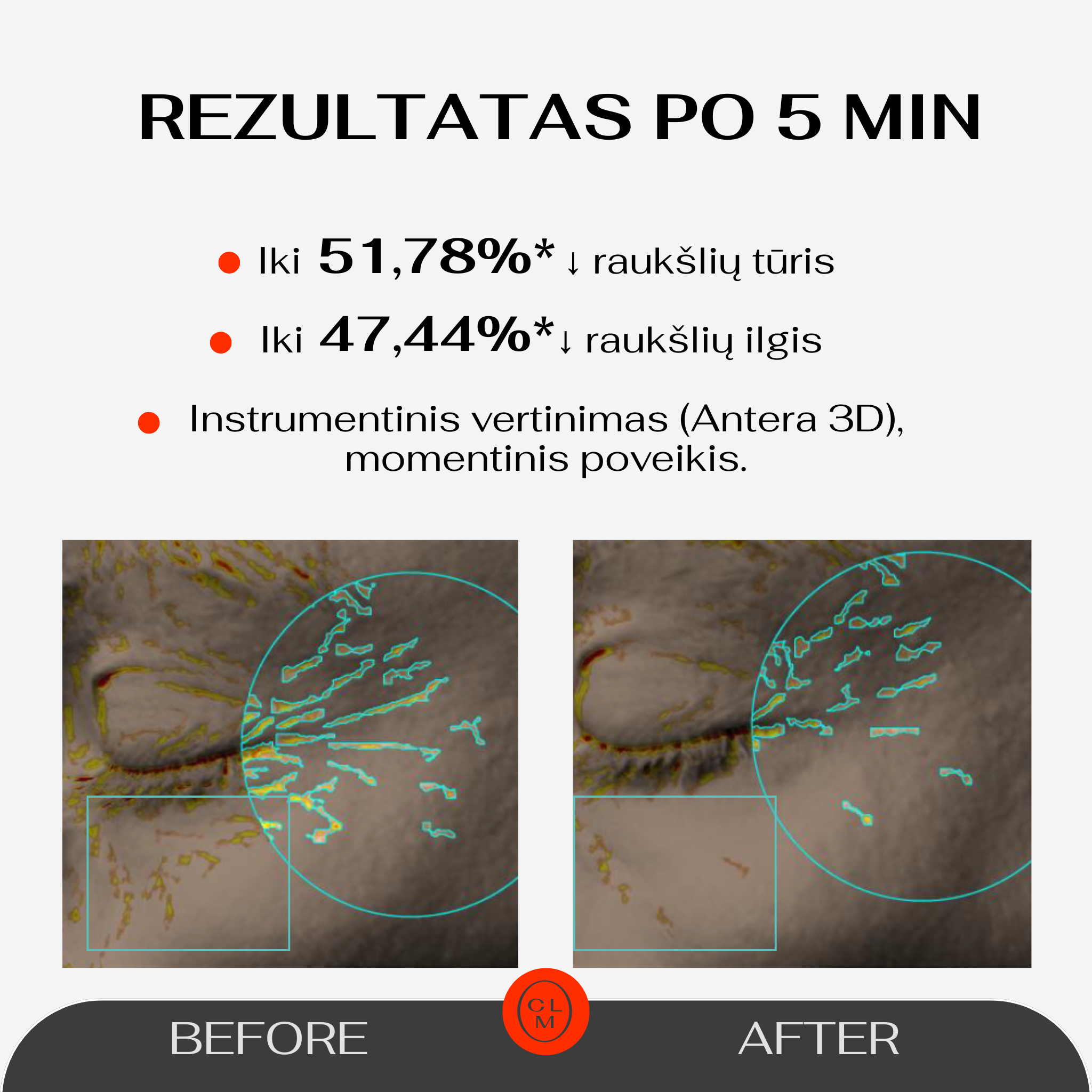 5 Minute Revolution Under-Eye Patches