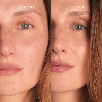 Face and neck skin care routine