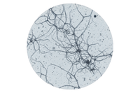5–20 kDa Hyaluronic acid